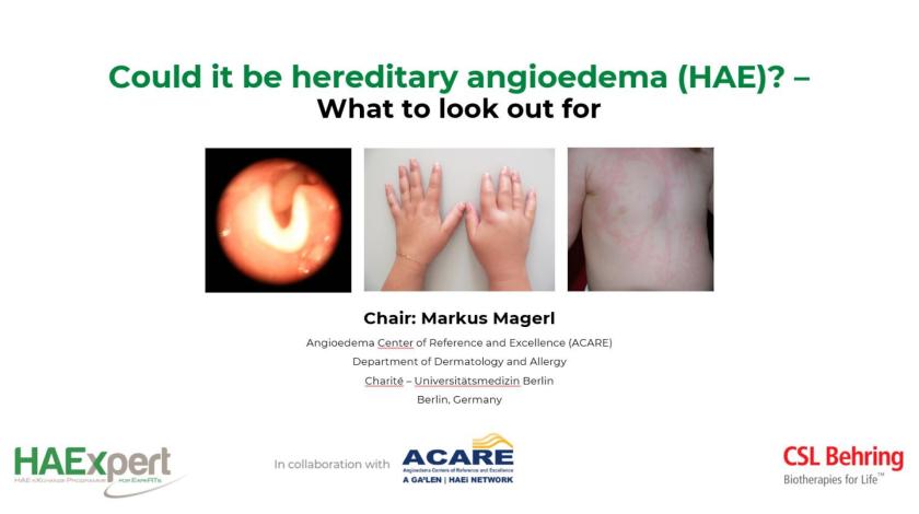 Could it be hereditary angioedema (HAE)? – What to look out for